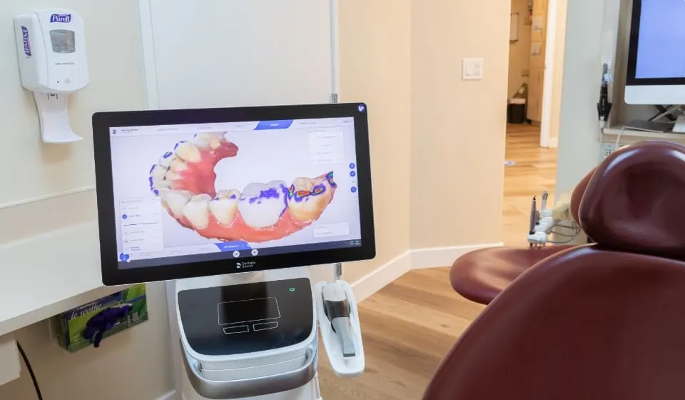 Intraoral scan displayed on a monitor in the Sunnyvale office